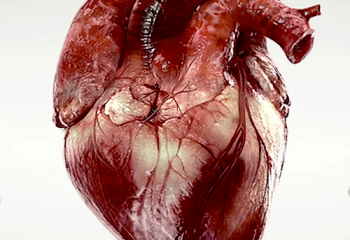 5 способов сохранить здоровое сердце