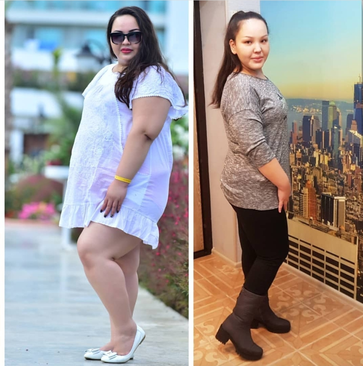 Лишний вес операция. Истории похудения 2022. Ожирение у девушек до и после фото. Фото до и после операции от ожирения. Похудела на 13 кг фото.