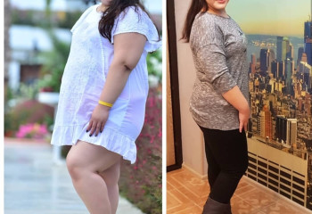 Борьба с ожирением: операция или правильное питание?