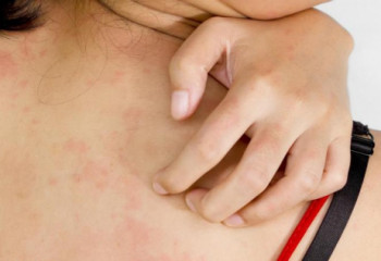 Адамның денесі неге қышиды?