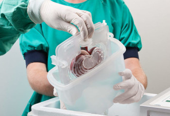 Еліміздегі трансплантология тынысы қалай?