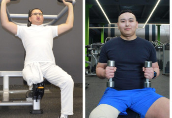 Ампутациядан кейінгі өмір