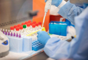 «Необходимо менять подходы в профилактике и лечении ВИЧ» - эксперты