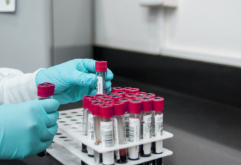 Более 100 человек в Казахстане заболели COVID-19 за минувшие сутки 