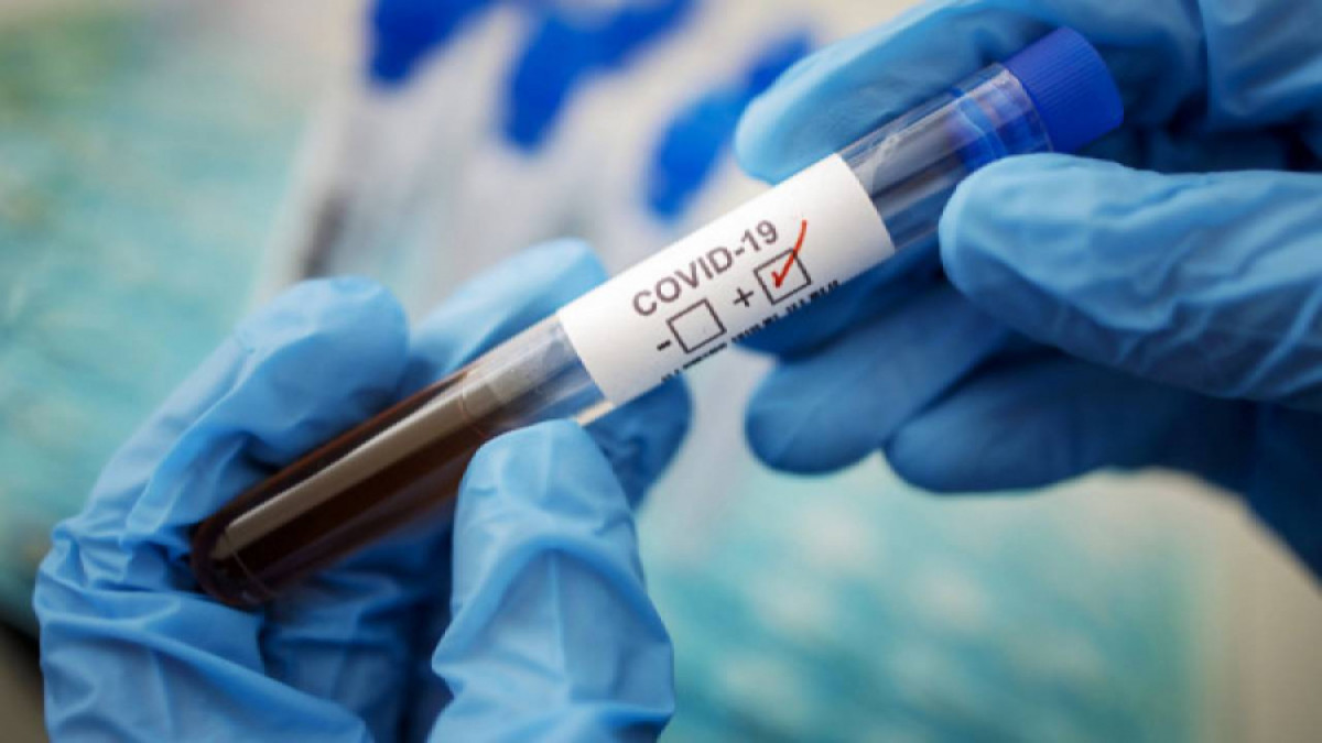  Kazakhstan confirms more than 100 new COVID-19 cases