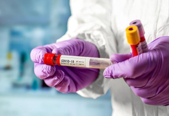 Елімізде коронавирус инфекциясын жұқтырғандардың жалпы саны 1 306 797 жетті