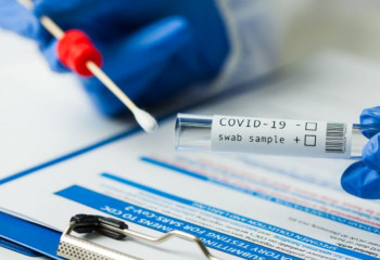 Қазақстанда КВИ жұқтырудың 1 307 517 дерегі анықталды   