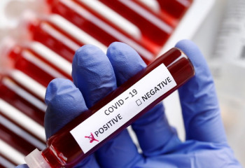 Өткен тәулікте коронавирус жұқтырған 1104 адам анықталды