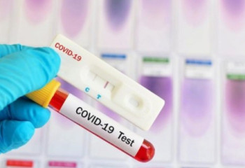 Қазақстанда коронавирус жұқтырғандар саны күн санап өсіп жатыр