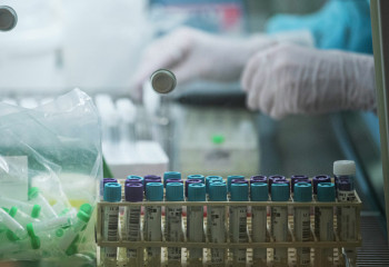 1470 new cases of COVID-19 registered in Kazakhstan 