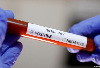 Қазақстанда тағы 1477 адамнан коронавирус анықталды