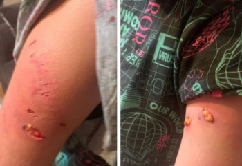 Хозяина собаки, покусавшей школьницу, оштрафовали в Караганде