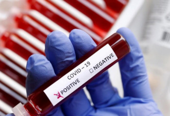 Өткен тәулікте 2257 адамнан коронавирус анықталды