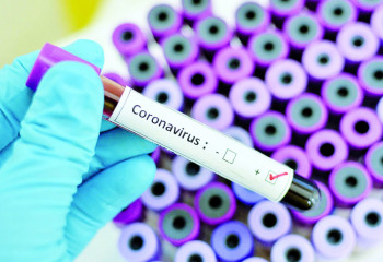 Өткен тәулікте 2 мыңнан астам адам коронавирус жұқтырды