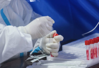 COVID-19 cases decline in Kazakhstan