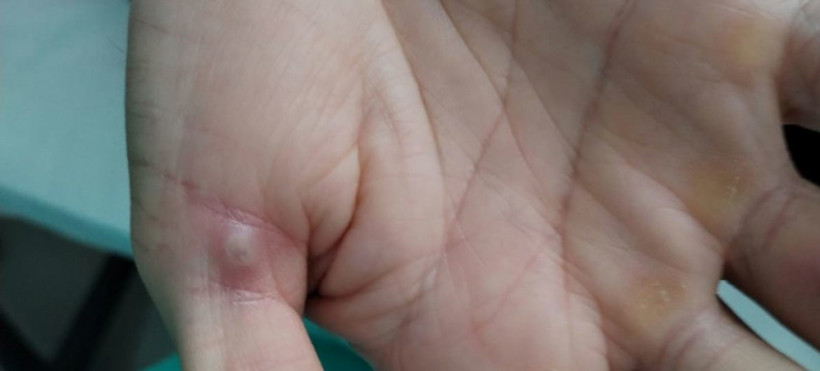  Кристины Муссини 