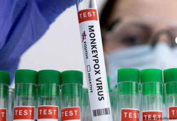 Monkeypox outbreak can be stopped - WHO