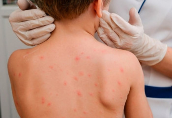 Бала денсаулығы – ұлт саулығы  