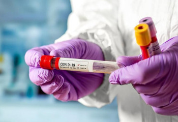 Өткен тәулікте 3095 адамнан коронавирус анықталды