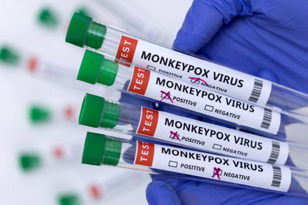 New York declares monkeypox emergency