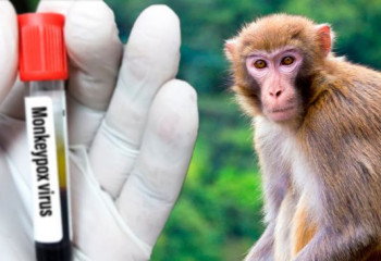 Случаев не зарегистрировано – Гиният об оспе обезьян в Казахстане 