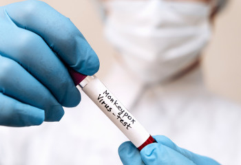 Experts give new names to variants of monkeypox virus