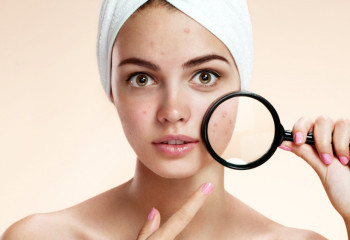 Безеуді қалай емдеуге болады?