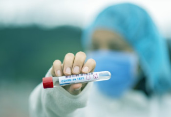 Бір тәулікте 1169 адам коронавирус инфекциясын жұқтырған