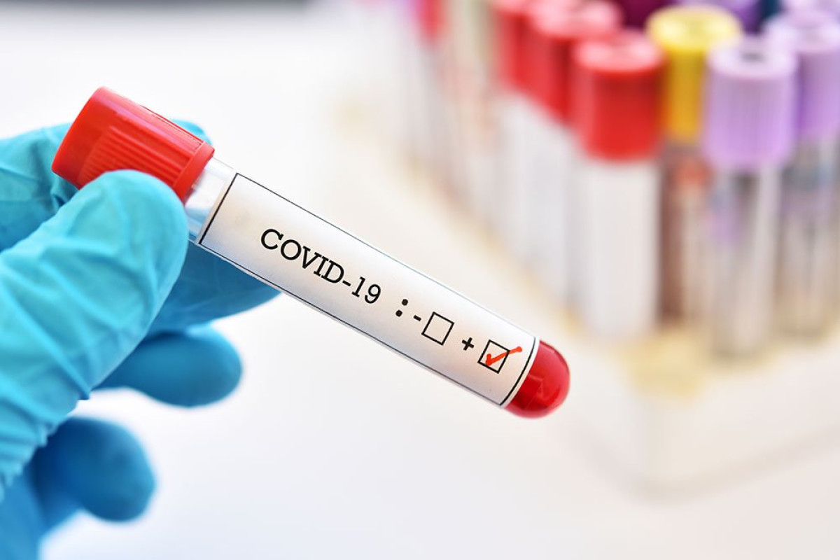 951 new Covid-19 cases detected in Kazakhstan