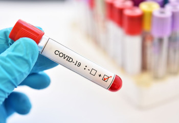 951 new Covid-19 cases detected in Kazakhstan