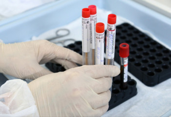 Елімізде коронавирус жұқтырғандар саны азайып келеді