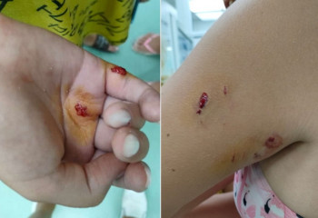 Ақтауда балаларды итбалық тістеп алды