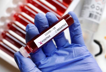 478 new COVID cases registered in Kazakhstan