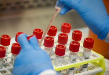 Kazakhstan reports 668 new COVID-19 cases