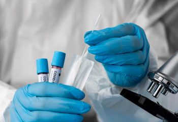 Число заражений КВИ составила менее ста человек 