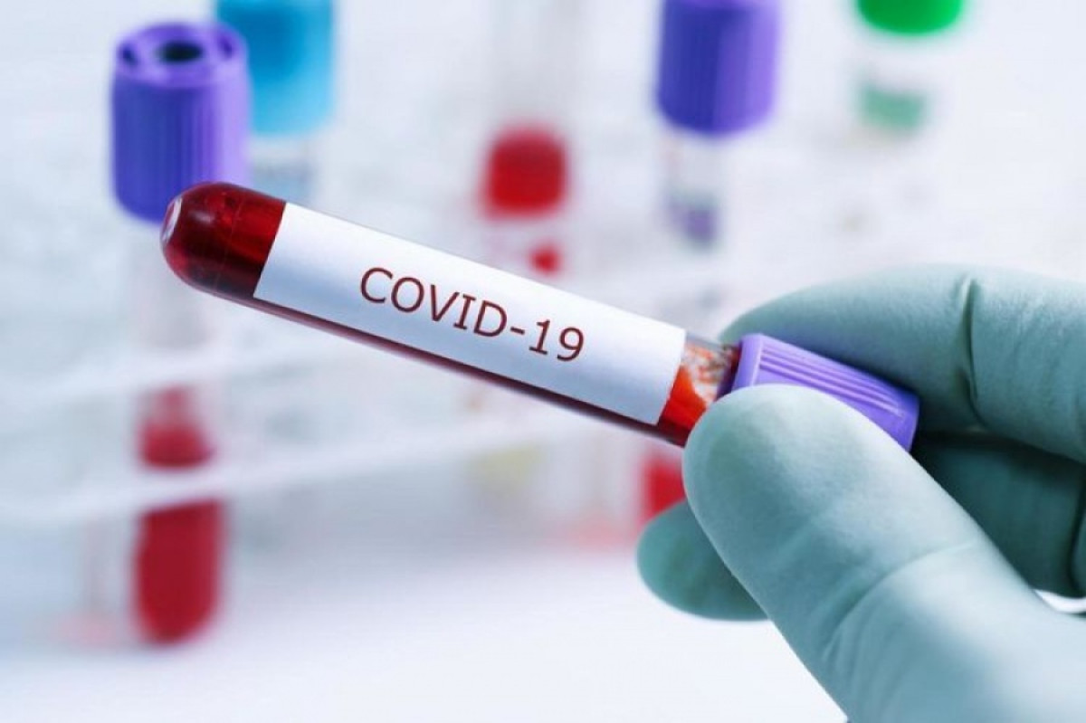 Өткен тәулікте 89 адамнан коронавирус анықталды