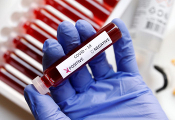 Өткен тәулікте 29 адамнан коронавирус анықталды