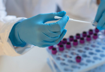 Өткен тәулікте тағы 58 адам коронавирус жұқтырды