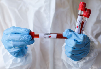 Өткен тәулікте 53 адамнан коронавирус анықталды