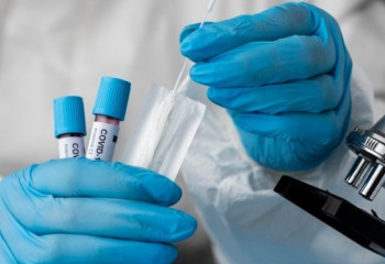 Елімізде 944 адам коронавирустан емделіп жатыр