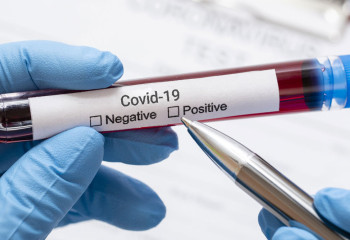 812 people getting treatment for coronavirus in Kazakhstan