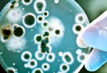 Бруцеллез выявлен в двух районах Туркестанской области