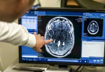 Минздрав назвал самые распространенные  виды онкологи в РК