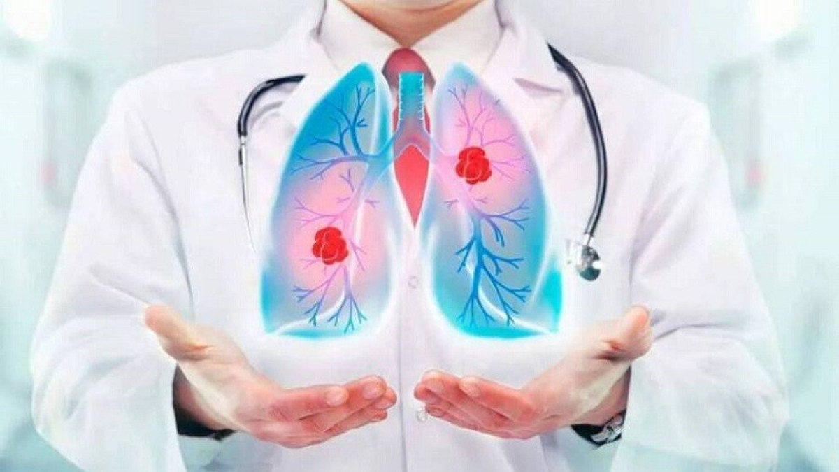 12 ноября отмечается Всемирный день пневмонии – Минздрав РК