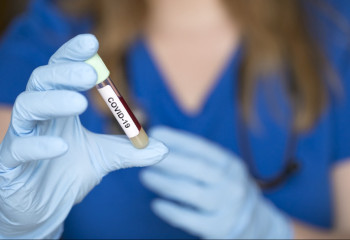 Лечение от КВИ продолжают получать 828 казахстанцев