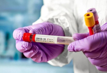 Өткен тәулікте 29 адамнан коронавирус анықталды