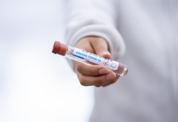 Өткен тәулікте 60 адамнан коронавирус анықталды