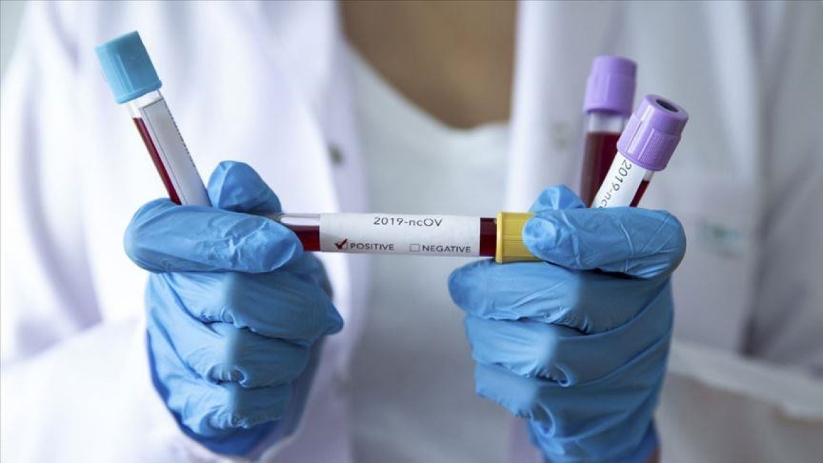 60 человек заболели коронавирусом в РК