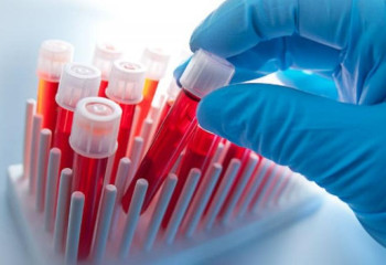 Ғалымдар алғаш рет адамға жасанды қан құйыды