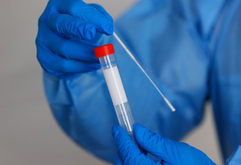 Лечение от КВИ продолжают получать 786 казахстанцев